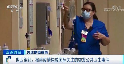 长春猴痘爆料事件视频,揭秘病毒传播与防控挑战 第3张 长春猴痘爆料事件视频,揭秘病毒传播与防控挑战 第3张